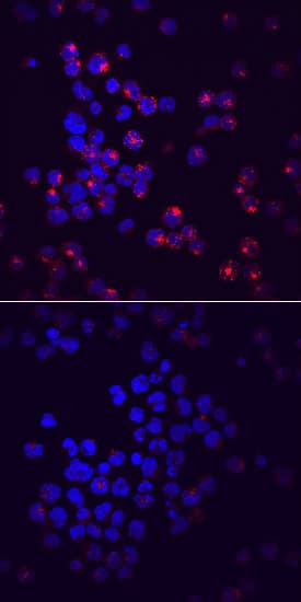 <b>Biological Strategies Validation. </b>Siglec-2/CD22 phosphorylated at Y822 was detected in immersion fixed Raji human Burkitt's lymphoma cell line unstimulated (lower panel) or stimulated (upper panel) with Pervanadate using Mouse Anti-Human Phospho-Siglec-2/CD22 (Y822) Monoclonal Antibody (Catalog # MAB7290) at 10 µg/mL for 3 hours at room temperature. Cells were stained using the NorthernLights™ 557-conjugated Anti-Mouse IgG Secondary Antibody (red; Catalog # NL007) and counterstained with DAPI (blue). Specific staining was localized to cytoplasm. View our protocol for Fluorescent ICC Staining of Non-adherent Cells.