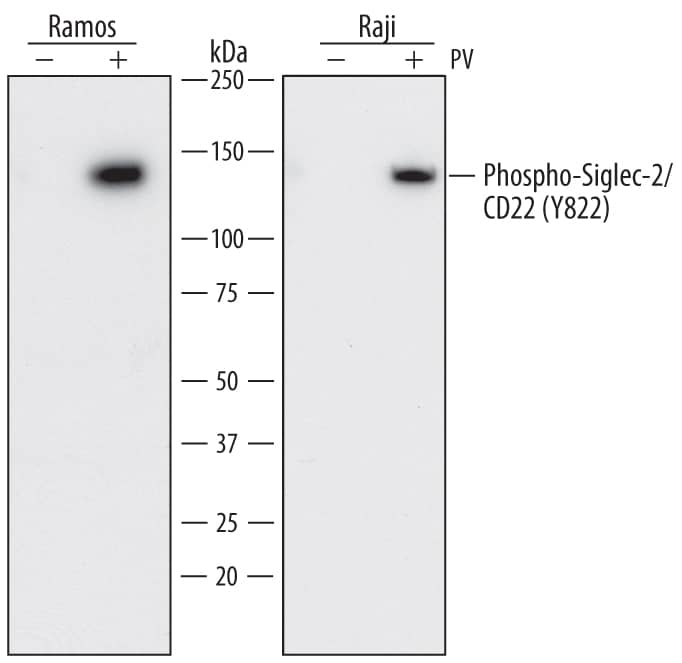 Western blot shows lysates of Ramos human Burkitt's lymphoma cell line and Raji human Burkitt's lymphoma cell line untreated (-) or treated (+) with 1 mM Pervanadate (PV) for 30 minutes. PVDF membrane was probed with 1 µg/mL of Mouse Anti-Human Phospho-Siglec-2/CD22 (Y822) Monoclonal Antibody (Catalog # MAB7290) followed by HRP-conjugated Anti-Mouse IgG Secondary Antibody (Catalog # HAF018). A specific band was detected for Siglec-2/CD22 at approximately 140 kDa (as indicated). This experiment was conducted under reducing conditions and using Immunoblot Buffer Group 1.