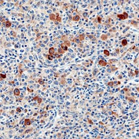 Siglec-11 was detected in immersion fixed paraffin-embedded sections of human lymph node using Mouse Anti-Human Siglec-11 Monoclonal Antibody (Catalog # MAB3258) at 5 µg/mL overnight at 4 °C. Before incubation with the primary antibody, tissue was subjected to heat-induced epitope retrieval using Antigen Retrieval Reagent-Basic (Catalog # CTS013). Tissue was stained using the Anti-Mouse HRP-DAB Cell & Tissue Staining Kit (brown; Catalog # CTS002) and counterstained with hematoxylin (blue). Specific staining was localized to cytoplasm. View our protocol for Chromogenic IHC Staining of Paraffin-embedded Tissue Sections.
