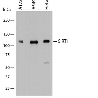 Western blot shows lysates of A172 human glioblastoma cell line, A549 human lung carcinoma cell line, and HeLa human cervical epithelial carcinoma cell line. PVDF membrane was probed with 0.2 µg/mL of Sheep Anti-Human Sirtuin 1/SIRT1 Antigen Affinity-purified Polyclonal Antibody (Catalog # AF7714) followed by HRP-conjugated Anti-Sheep IgG Secondary Antibody (Catalog # HAF016). A specific band was detected for Sirtuin 1/SIRT1 at approximately 120 kDa (as indicated). This experiment was conducted under reducing conditions and using Immunoblot Buffer Group 1.