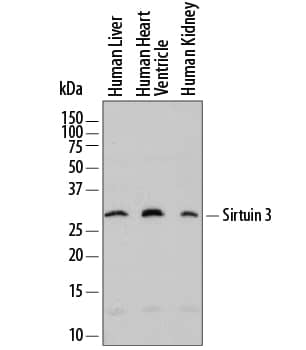 Western blot shows lysates of human liver tissue, human heart ventricle tissue, and human kidney tissue. PVDF membrane was probed with 0.2 µg/mL of Sheep Anti-Human Sirtuin 3/SIRT3 Antigen Affinity-purified Polyclonal Antibody (Catalog # AF7488) followed by HRP-conjugated Anti-Sheep IgG Secondary Antibody (Catalog # HAF016). A specific band was detected for Sirtuin 3/SIRT3 at approximately 28 kDa (as indicated). This experiment was conducted under reducing conditions and using Immunoblot Buffer Group 1.