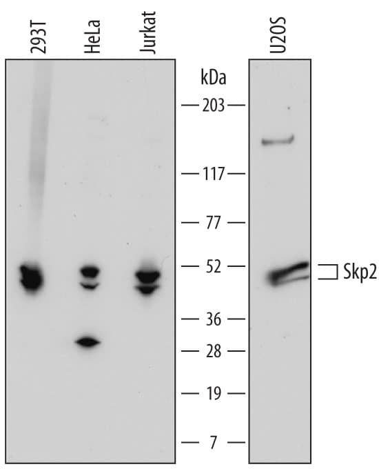 Western Blot Skp2 Antibody (712120) [Unconjugated]