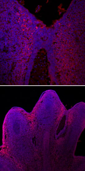 Slit2 was detected in immersion fixed frozen sections of E13.5 mouse hindlimb, shown localized to interdigital region (upper panel), using Sheep Anti-Mouse Slit2 Antigen Affinity-purified Polyclonal Antibody (Catalog # AF5444) at 10 µg/mL overnight at 4 °C. Tissue was stained using the NorthernLights™ 557-conjugated Anti-Sheep IgG Secondary Antibody (red; Catalog # NL010) and counterstained with DAPI (blue). Specific staining was localized to cell surfaces and cytoplasm. View our protocol for Fluorescent IHC Staining of Frozen Tissue Sections.