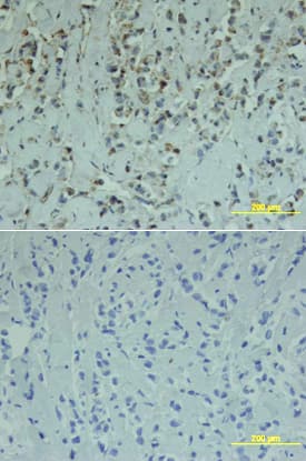 Smad1 was detected in immersion fixed paraffin-embedded sections of human breast array using Goat Anti-Human Smad1 Antigen Affinity-purified Polyclonal Antibody (Catalog # AF2039) at 15 µg/mL overnight at 4 °C. Tissue was stained using the Anti-Goat HRP-DAB Cell & Tissue Staining Kit (brown; Catalog # CTS008) and counterstained with hematoxylin (blue). Lower panel shows a lack of labeling if primary antibodies are omitted and tissue is stained only with secondary antibody followed by incubation with detection reagents. View our protocol for Chromogenic IHC Staining of Paraffin-embedded Tissue Sections.