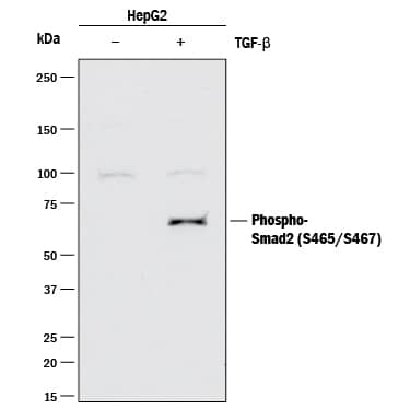 Western Blot Smad2/3 [p Ser465, p Ser467] Antibody (1074A) [Unconjugated]