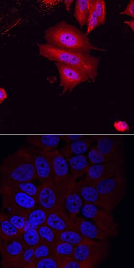 Smad2/3 was detected in immersion fixed MCF-7 human breast cancer cell line induced (upper panel) or non-induced (lower panel) to undergo epithelial-mesenchymal transition (EMT) using Goat Anti-Human/Mouse Smad2/3 Antigen Affinity-purified Polyclonal Antibody (Catalog # AF3797) at 10 µg/mL for 3 hours at room temperature. Cells were stained using the NorthernLights™ 557-conjugated Anti-Goat IgG Secondary Antibody (red; Catalog # NL001) and counterstained with DAPI (blue). Specific staining was localized to cytoplasm and, in EMT-induced cells, nuclei. View our protocol for Fluorescent ICC Staining of Cells on Coverslips.