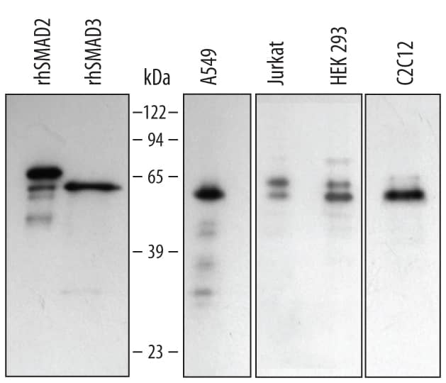 Western Blot Smad2/3 Antibody [Unconjugated]