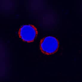 Immunocytochemistry Smad4 Antibody [Unconjugated]