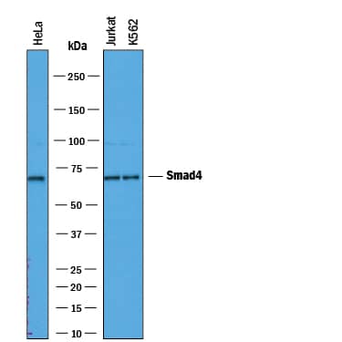Western Blot Smad4 Antibody [Unconjugated]