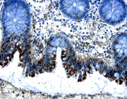 Smad5 was detected in immersion fixed paraffin-embedded sections of human colon using 5 &micro;g/mL Human Smad5 Antigen Affinity-purified Polyclonal Antibody (Catalog # AF2250) overnight at 4 &deg;C. Tissue was stained with the Anti-Goat HRP-DAB Cell & Tissue Staining Kit (brown; Catalog # CTS008) and counterstained with hematoxylin (blue). Specific labeling was localized to the cytoplasm of epithelial cells. View our protocol for Chromogenic IHC Staining of Paraffin-embedded Tissue Sections.