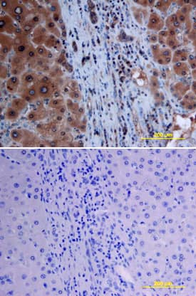 Smad7 was detected in immersion fixed paraffin-embedded sections of human liver array using Human/Mouse/Rat Smad7 Monoclonal Antibody (Catalog # MAB2029) at 25 µg/mL overnight at 4 °C. Tissue was stained using the Anti-Mouse HRP-DAB Cell & Tissue Staining Kit (brown; Catalog # CTS002) and counterstained with hematoxylin (blue). Lower panel shows a lack of labeling if primary antibodies are omitted and tissue is stained only with secondary antibody followed by incubation with detection reagents. View our protocol for Chromogenic IHC Staining of Paraffin-embedded Tissue Sections.