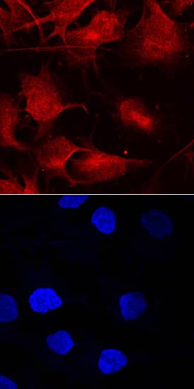 Immunocytochemistry Smad9 Antibody