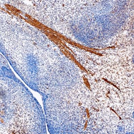 Immunohistochemistry Smad9 Antibody