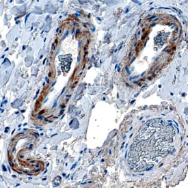 Smoothelin B was detected in formalin fixed paraffin-embedded sections of human colon using Mouse Anti-Human Smoothelin B Monoclonal Antibody (Catalog # MAB8278) at 5 µg/mL overnight at 4 °C. Tissue was stained using the Anti-Mouse HRP-DAB Cell & Tissue Staining Kit (brown; Catalog # CTS002) and counterstained with hematoxylin (blue). Specific staining was localized to smooth muscle cells in vasculature. View our protocol for Chromogenic IHC Staining of Paraffin-embedded Tissue Sections.