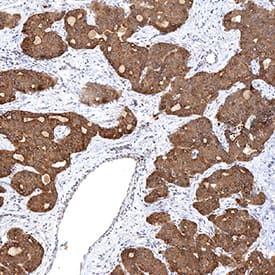 Immunohistochemistry Smoothened Antibody (1015418) [Unconjugated]