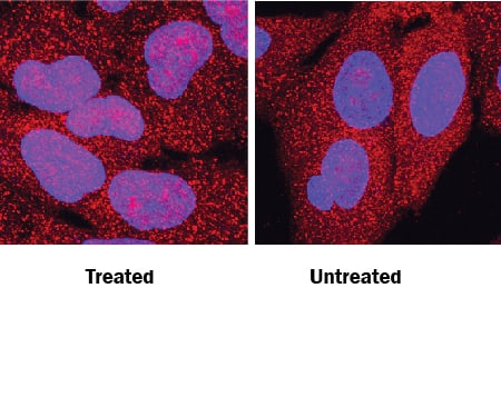 Immunocytochemistry Snail Antibody [Unconjugated]
