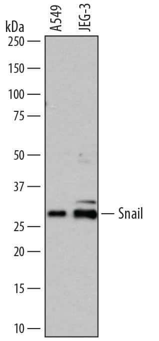 Western Blot Snail Antibody [Unconjugated]
