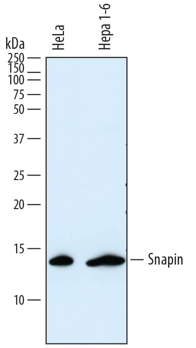 Western Blot Snapin Antibody (809116)