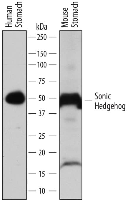 Western blot shows lysates of human stomach tissue and mouse stomach tissue. PVDF membrane was probed with 1 µg/mL of Goat Anti-Mouse Sonic Hedgehog/Shh C-Terminus Antigen Affinity-purified Polyclonal Antibody (Catalog # AF445) followed by HRP-conjugated Anti-Goat IgG Secondary Antibody (Catalog # HAF109). A specific band was detected for Sonic Hedgehog/Shh at approximately 50 kDa (as indicated). This experiment was conducted under reducing conditions and using Immunoblot Buffer Group 1.