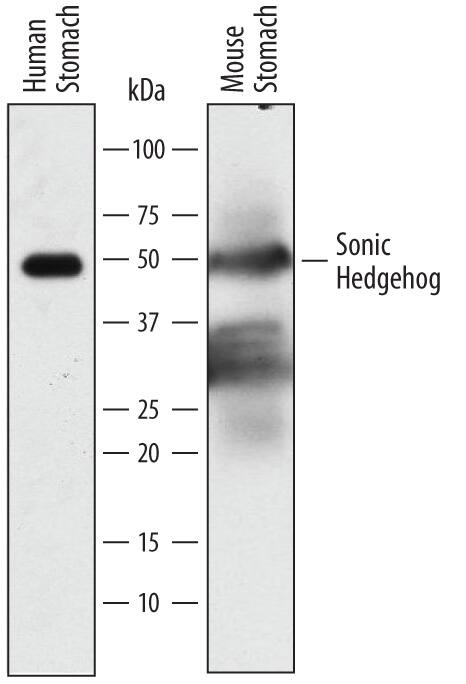 Western blot shows lysates of human stomach tissue and mouse stomach tissue. PVDF membrane was probed with 2 µg/mL of Goat Anti-Mouse Sonic Hedgehog/Shh C-Terminus Biotinylated Antigen Affinity-purified Polyclonal Antibody (Catalog # BAF445) followed by Streptavidin-HRP. A specific band was detected for Sonic Hedgehog/Shh at approximately 50 kDa (as indicated). This experiment was conducted under reducing conditions and using Immunoblot Buffer Group 1.