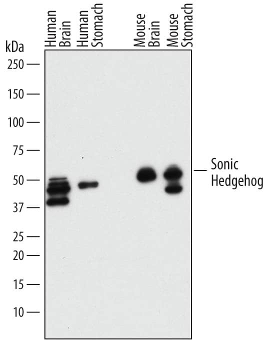 Western Blot Sonic Hedgehog/Shh Antibody (171018) [Unconjugated] - N-Terminus