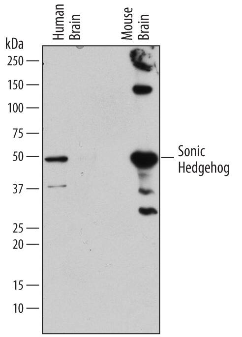 Western blot shows lysates of human brain tissue and mouse brain tissue. PVDF membrane was probed with 2 µg/mL of Rat Anti-Human/Mouse Sonic Hedgehog/Shh N-Terminus Monoclonal Antibody (Catalog # MAB464) followed by HRP-conjugated Anti-Rat IgG Secondary Antibody (Catalog # HAF005). A specific band was detected for Sonic Hedgehog/Shh at approximately 50 kDa (as indicated). This experiment was conducted under reducing conditions and using Immunoblot Buffer Group 1.