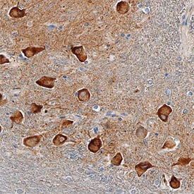 SorCS2 was detected in immersion fixed paraffin-embedded sections of human brain (medulla) using Sheep Anti-Human SorCS2 Antigen Affinity-purified Polyclonal Antibody (Catalog # AF4238) at 3 µg/mL overnight at 4 °C. Before incubation with the primary antibody, tissue was subjected to heat-induced epitope retrieval using Antigen Retrieval Reagent-Basic (Catalog # CTS013). Tissue was stained using the Anti-Sheep HRP-DAB Cell & Tissue Staining Kit (brown; Catalog # CTS019) and counterstained with hematoxylin (blue). Specific staining was localized to neurons and their processes. View our protocol for Chromogenic IHC Staining of Paraffin-embedded Tissue Sections.