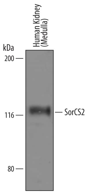 Western blot shows lysates of human kidney (medulla) tissue. PVDF Membrane was probed with 1 µg/mL of Sheep Anti-Human SorCS2 Antigen Affinity-purified Antibody (Catalog # AF4238) followed by HRP-conjugated Anti-Sheep IgG Secondary Antibody (Catalog # HAF016). A specific band was detected for SorCS2 at approximately 120 kDa (as indicated). This experiment was conducted under reducing conditions and using Immunoblot Buffer Group 8.