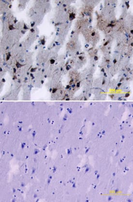 Immunohistochemistry SorLA Antibody (525122)