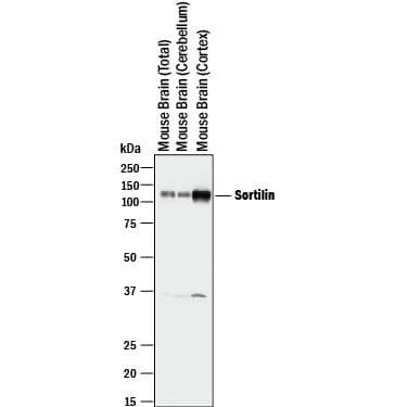 Western Blot Sortilin Antibody [Unconjugated]