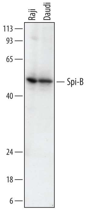 Western blot shows lysates of Raji human Burkitt's lymphoma cell line and Daudi human Burkitt's lymphoma cell line. PVDF membrane was probed with 1 µg/mL of Mouse Anti-Human Spi-B Monoclonal Antibody (Catalog # MAB7576) followed by HRP-conjugated Anti-Mouse IgG Secondary Antibody (Catalog # HAF018). A specific band was detected for Spi-B at approximately 45 kDa (as indicated). This experiment was conducted under reducing conditions and using Immunoblot Buffer Group 1.