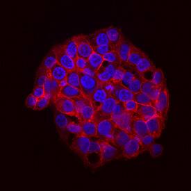 <b>Biological Strategies Validation. </b>Src phosphorylated at Y416 was detected in immersion fixed HepG2 human hepatocellular carcinoma cell line treated with Pervanadate using Rabbit Anti-Human Phospho-Src (Y416) Monoclonal Antibody (Catalog # MAB2685) at 2 µg/mL for 3 hours at room temperature. Cells were stained using the NorthernLights™ 557-conjugated Anti-Rabbit IgG Secondary Antibody (red; Catalog # NL004) and counterstained with DAPI (blue). View our protocol for Fluorescent ICC Staining of Cells on Coverslips.