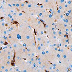 Stabilin-1 was detected in immersion fixed paraffin-embedded sections of human liver using Mouse Anti-Human Stabilin-1 Monoclonal Antibody (Catalog # MAB3825) at 15 µg/mL overnight at 4 °C. Before incubation with the primary antibody, tissue was subjected to heat-induced epitope retrieval using Antigen Retrieval Reagent-Basic (Catalog # CTS013). Tissue was stained using the Anti-Mouse HRP-DAB Cell & Tissue Staining Kit (brown; Catalog # CTS002) and counterstained with hematoxylin (blue). Specific staining was localized to endothelial cells in bile canaliculi. View our protocol for Chromogenic IHC Staining of Paraffin-embedded Tissue Sections.