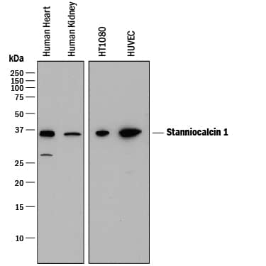 Western Blot Stanniocalcin 1/STC-1 Antibody (380715) [Unconjugated]