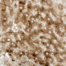 Stathmin-2/STMN2 was detected in immersion fixed paraffin-embedded sections of human liver using Mouse Anti-Human Stathmin-2/STMN2 Monoclonal Antibody (Catalog # MAB6930) at 15 µg/mL overnight at 4 °C. Tissue was stained using the Anti-Mouse HRP-DAB Cell & Tissue Staining Kit (brown; Catalog # CTS002) and counterstained with hematoxylin (blue). Specific staining was localized to hepatocytes. View our protocol for Chromogenic IHC Staining of Paraffin-embedded Tissue Sections.