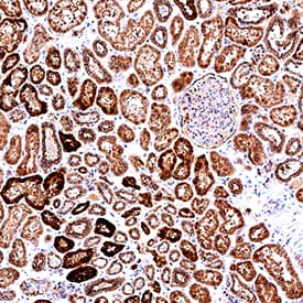 Sulfamidase/SGSH was detected in immersion fixed paraffin-embedded sections of human kidney using Mouse Anti-Human/Mouse Sulfamidase/SGSH Monoclonal Antibody (Catalog # MAB83801) at 5 µg/mL for 1 hour at room temperature followed by incubation with the Anti-Mouse IgG VisUCyte™ HRP Polymer Antibody (Catalog # VC001). Before incubation with the primary antibody, tissue was subjected to heat-induced epitope retrieval using Antigen Retrieval Reagent-Basic (Catalog # CTS013). Tissue was stained using DAB (brown) and counterstained with hematoxylin (blue). Specific staining was localized to convoluted tubules and glomeruli. View our protocol for IHC Staining with VisUCyte HRP Polymer Detection Reagents.