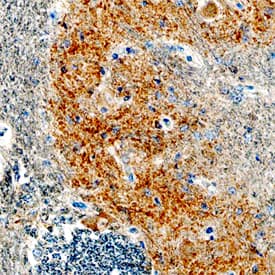 Synaptophysin was detected in immersion fixed paraffin-embedded sections of human brainstem tissue using Goat Anti-Human Synaptophysin Antigen Affinity-purified Polyclonal Antibody (Catalog # AF5555) at 1.7 µg/mL overnight at 4 °C. Tissue was stained using the Anti-Goat HRP-DAB Cell & Tissue Staining Kit (brown; Catalog # CTS008) and counterstained with hematoxylin (blue). Specific staining was localized to olivary nucleus. View our protocol for Chromogenic IHC Staining of Paraffin-embedded Tissue Sections. *Not recommended for Immunohistochemistry/Immunocytochemistry on mouse and rat samples.