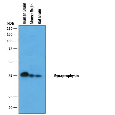 Western blot shows lysates of human brain tissue, mouse brain tissue, and rat brain tissue. PVDF membrane was probed with 1 µg/mL of Goat Anti-Human Synaptophysin Antigen Affinity-purified Polyclonal Antibody (Catalog # AF5555) followed by HRP-conjugated Anti-Goat IgG Secondary Antibody (Catalog # HAF019). A specific band was detected for Synaptophysin at approximately 38 kDa (as indicated). This experiment was conducted under reducing conditions and using Immunoblot Buffer Group 1.