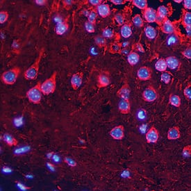 Synaptophysin was detected in perfusion fixed frozen sections of mouse brain (hippocampus) using Mouse Anti-Human Synaptophysin Monoclonal Antibody (Catalog # MAB5555) at 15 µg/mL overnight at 4 °C. Tissue was stained using the NorthernLights™ 557-conjugated Anti-Mouse IgG Secondary Antibody (red; Catalog # NL007) and counterstained with DAPI (blue). Specific staining was localized to cytoplasm and nuclei. View our protocol for Fluorescent IHC Staining of Frozen Tissue Sections.