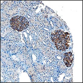 Synaptopodin was detected in immersion fixed paraffin-embedded sections of human kidney using Mouse Anti-Human Synaptopodin Monoclonal Antibody (Catalog # MAB8977) at 15 µg/mL overnight at 4 °C. Tissue was stained using the Anti-Mouse HRP-DAB Cell & Tissue Staining Kit (brown; Catalog # CTS002) and counterstained with hematoxylin (blue). Specific staining was localized to glomeruli. View our protocol for Chromogenic IHC Staining of Paraffin-embedded Tissue Sections.
