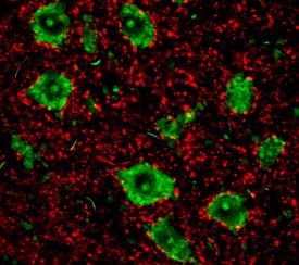 Synaptotagmin-1 was detected in perfusion fixed frozen sections of rat spinal cord using 8 µg/mL Mouse Anti-Rat Synaptotagmin-1 Monoclonal Antibody (Catalog # MAB43641) overnight at 4 °C. Tissue was stained (red) and counterstained (green). View our protocol for Fluorescent IHC Staining of Frozen Tissue Sections.