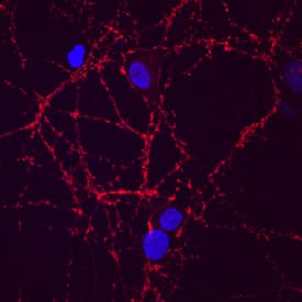 Immunocytochemistry Synaptotagmin 1 Antibody (ASV48) [Unconjugated]
