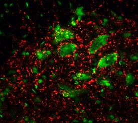 Synaptotagmin was detected in perfusion fixed frozen sections of rat spinal cord using 8 µg/mL Mouse Anti-Rat Synaptotagmin Monoclonal Antibody (Catalog # MAB4364) overnight at 4 °C. Tissue was stained (red) and counter-stained (green). View our protocol for Fluorescent IHC Staining of Frozen Tissue Sections.