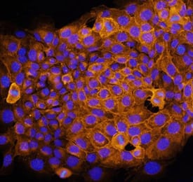 Syndecan-1/CD138 was detected in immersion fixed NMuMG mouse mammary gland epithelial cell line using Mouse Syndecan-1/CD138 Antigen Affinity-purified Polyclonal Antibody (Catalog # AF3190) at 10 µg/mL for 3 hours at room temperature. Cells were stained using the NorthernLights™ 557-conjugated Anti-Goat IgG Secondary Antibody (yellow; Catalog # NL001) and counterstained with DAPI (blue). Specific staining was localized to cell surfaces and cytoplasm. View our protocol for Fluorescent ICC Staining of Cells on Coverslips.