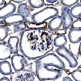 Syndecan-1/CD138 was detected in perfusion fixed frozen sections of mouse kidney using Goat Anti-Mouse Syndecan-1/CD138 Antigen Affinity-purified Polyclonal Antibody (Catalog # AF3190) at 3 µg/mL for 1 hour at room temperature followed by incubation with the Anti-Goat IgG VisUCyte™ HRP Polymer Antibody (Catalog # VC004). Tissue was stained using DAB (brown) and counterstained with hematoxylin (blue). Specific staining was localized to glomeruli and convoluted tubules. View our protocol for IHC Staining with VisUCyte HRP Polymer Detection Reagents.