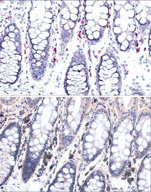 <b>Orthogonal Strategies Validation. </b>Syndecan-1/CD138 mRNA was detected in formalin-fixed paraffin-embedded tissue sections of human colon probed with ACD RNAScope®Probe (Catalog # 416961) and stained using ACD RNAscope®2.5 HD Duplex Detection Reagents (red, Catalog # 322500). Adjacent tissue section was processed for immunohistochemistry using R&D Systems Rat Anti-Human Syndecan-1/CD138 Monoclonal Antibody (Catalog# MAB2780) at 0.5 ug/mL for 1 hour at room temperature followed by incubation with the Anti-Rat IgG VisUCyte HRP Polymer Antibody (R&D Systems, Catalog # VC005) and DAB chromogen (brown). Tissues were counterstained with hematoxylin (blue).