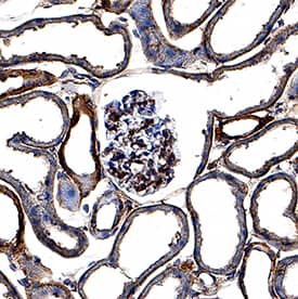 Syndecan-1/CD138 was detected in perfusion fixed frozen sections of mouse kidney using Rat Anti-Mouse Syndecan-1/CD138 Monoclonal Antibody (Catalog # MAB29661) at 1.7 µg/mL for 1 hour at room temperature followed by incubation with the Anti-Mouse IgG VisUCyte™ HRP Polymer Antibody (Catalog # VC001). Tissue was stained using DAB (brown) and counterstained with hematoxylin (blue). Specific staining was localized to glomeruli and convoluted tubules. View our protocol for IHC Staining with VisUCyte HRP Polymer Detection Reagents.