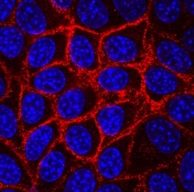 Syndecan-1/CD138 was detected in immersion fixed NMuMG mouse mammary gland epithelial cell line using Rat Anti-Mouse Syndecan-1/CD138 Monoclonal Antibody (Catalog # MAB2966) at 10 µg/mL for 3 hours at room temperature. Cells were stained using the NorthernLights™ 557-conjugated Anti-Rat IgG Secondary Antibody (red; Catalog # NL013) and counterstained with DAPI (blue). Specific staining was localized to cell surfaces. View our protocol for Fluorescent ICC Staining of Cells on Coverslips.