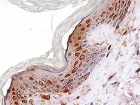 Syndecan-2/CD362 was detected in immersion fixed paraffin-embedded sections of human skin using Goat Anti-Human Syndecan-2/CD362 Antigen Affinity-purified Polyclonal Antibody (Catalog # AF2965) at 15 µg/mL overnight at 4 °C. Tissue was stained using the Anti-Goat HRP-DAB Cell & Tissue Staining Kit (brown; Catalog # CTS008) and counterstained with hematoxylin (blue). Specific staining was localized to keratinocytes. View our protocol for Chromogenic IHC Staining of Paraffin-embedded Tissue Sections.