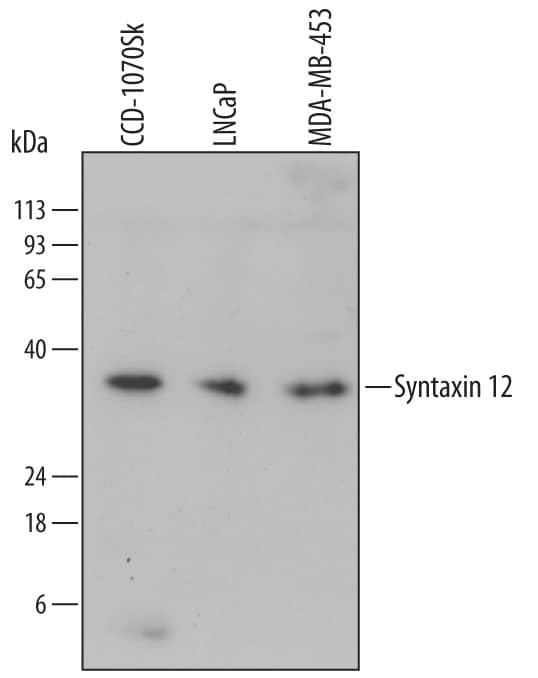 Western blot shows lysates of CCD-1070Sk human foreskin fibroblast cell line, LNCaP human prostate cancer cell line, and MDA-MB-453 human breast cancer cell line. PVDF Membrane was probed with 1 µg/mL of Mouse Anti-Human Syntaxin 12 Monoclonal Antibody (Catalog # MAB6617) followed by HRP-conjugated Anti-Mouse IgG Secondary Antibody (Catalog # HAF007). A specific band was detected for Syntaxin 12 at approximately 30 kDa (as indicated). This experiment was conducted under reducing conditions and using Immunoblot Buffer Group 1.